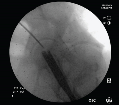 Details are in the caption following the image Details are in the caption following the image