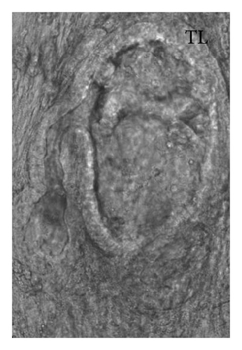 Details are in the caption following the image