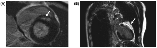 Details are in the caption following the image Details are in the caption following the image