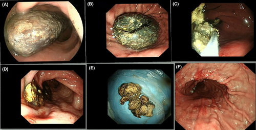 Details are in the caption following the image Details are in the caption following the image