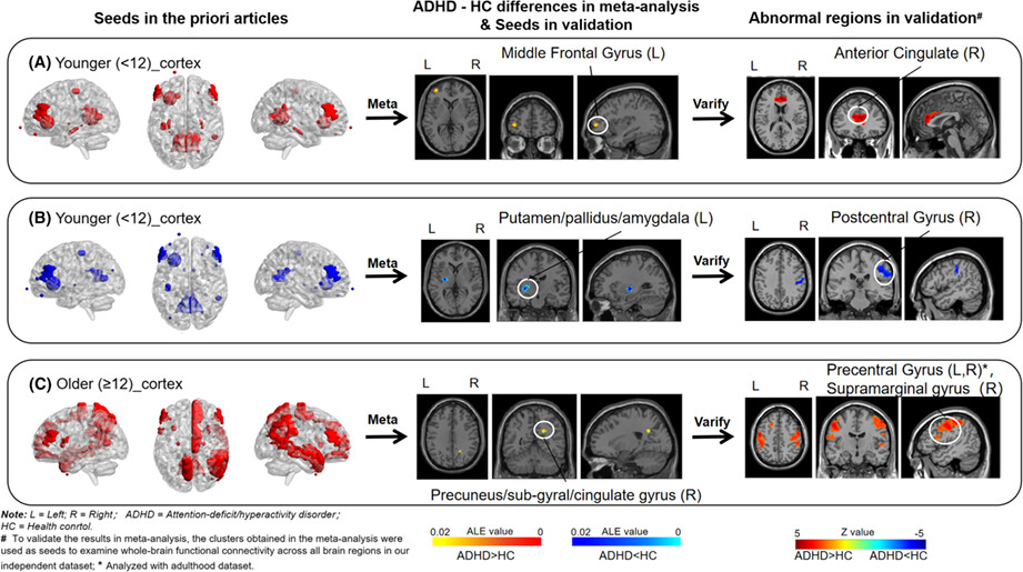 Different functional alteration in attention-deficit/hyperactivity disorder across developmental age groups: A meta-analysis and an independent validation of resting-state functional connectivity studies
