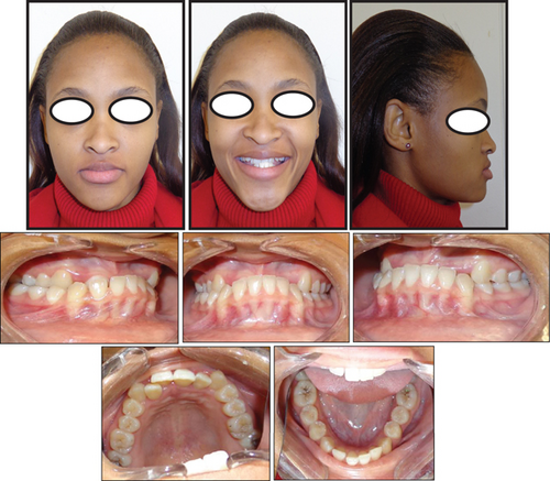 Details are in the caption following the image Details are in the caption following the image
