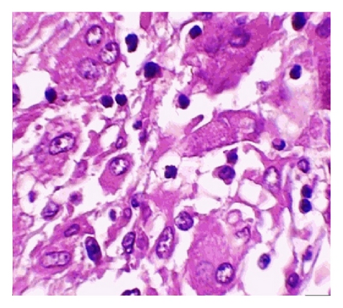 Details are in the caption following the image