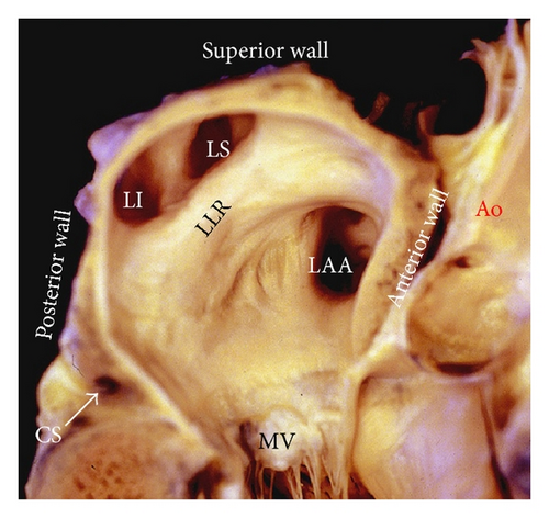 Details are in the caption following the image