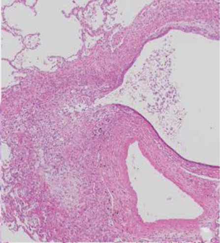 Details are in the caption following the image