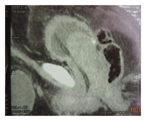 Details are in the caption following the image