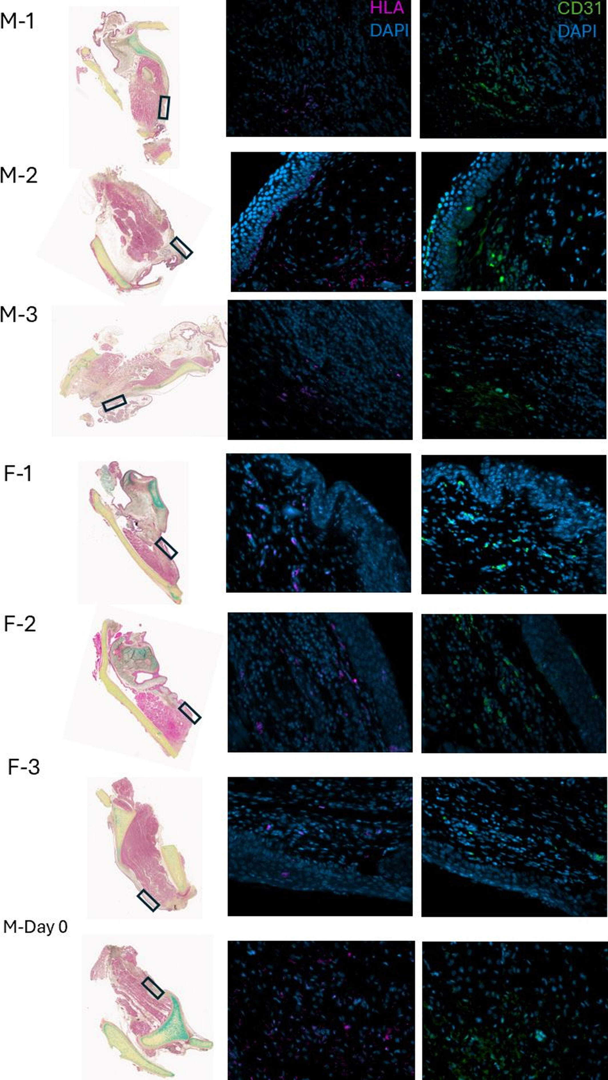 Immunocytochemistry assessment of vocal fold regeneration after cell-based implant in rabbits