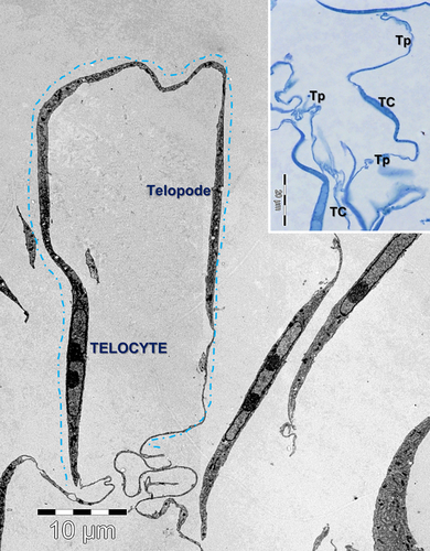 Details are in the caption following the image