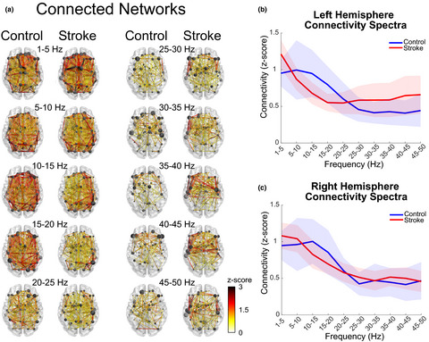 Electroencephalography resting-state networks in people with Stroke