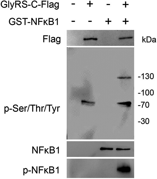Amino acids stimulate glycyl-tRNA synthetase nuclear localization for mammalian target of rapamycin expression in bovine mammary epithelial cells