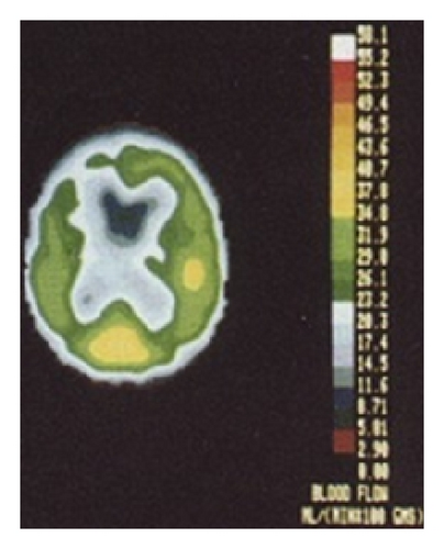 Details are in the caption following the image