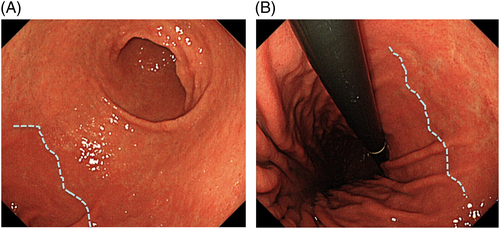 Details are in the caption following the image Details are in the caption following the image