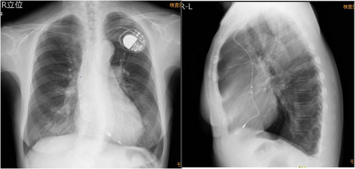 Details are in the caption following the image Details are in the caption following the image