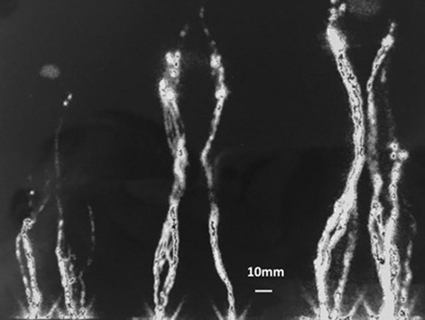 Imaging lymphatics in human normal and lymphedema limbs—Usefulness of various modalities for evaluation of lymph and edema fluid flow pathways and dynamics