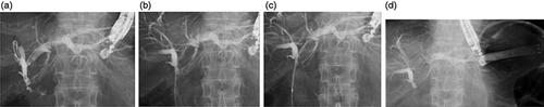 Details are in the caption following the image Details are in the caption following the image