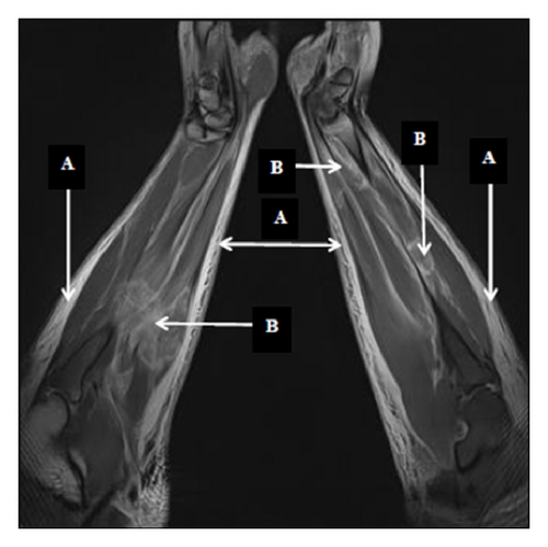 Details are in the caption following the image
