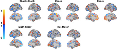 Toward a “treadmill test” for cognition: Improved prediction of general cognitive ability from the task activated brain
