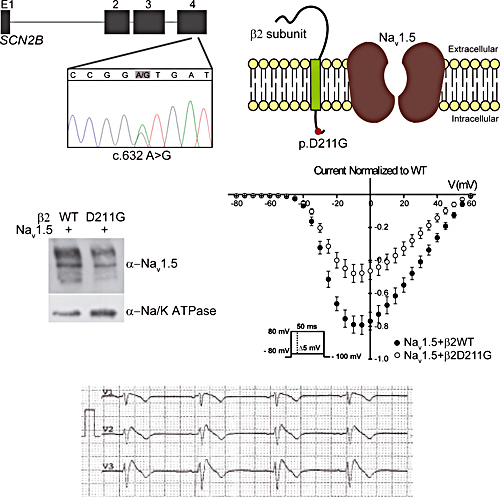 A Missense Mutation in the Sodium Channel β2 Subunit Reveals SCN2B as a New Candidate Gene for Brugada Syndrome