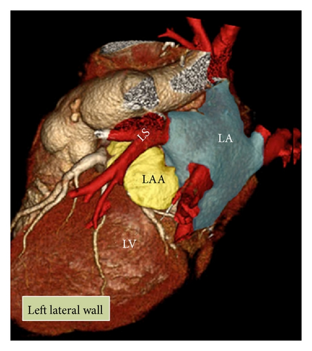 Details are in the caption following the image