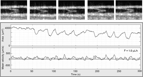 Simultaneous measurements of lymphatic vessel contraction, flow and valve dynamics in multiple lymphangions using optical coherence tomography