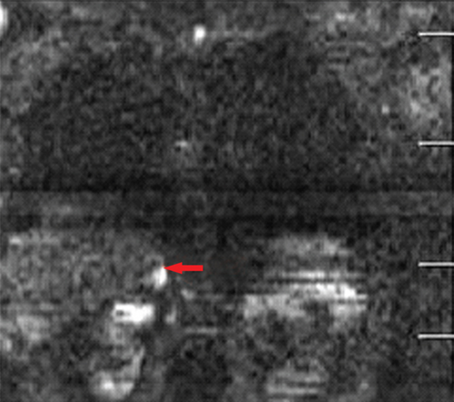 Details are in the caption following the image