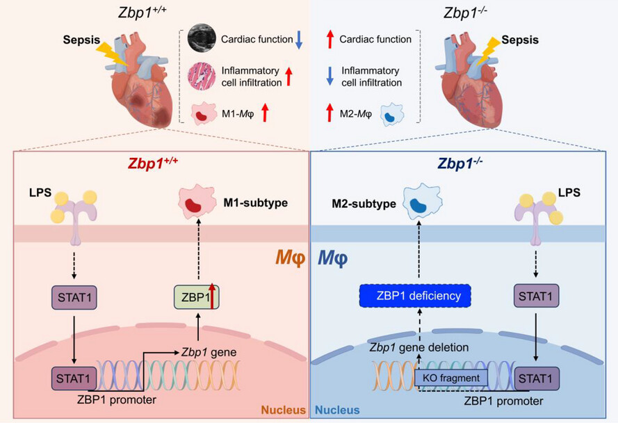 Myeloid deficiency of Z-DNA binding protein 1 restricts septic cardiomyopathy via promoting macrophage polarisation towards the M2-subtype