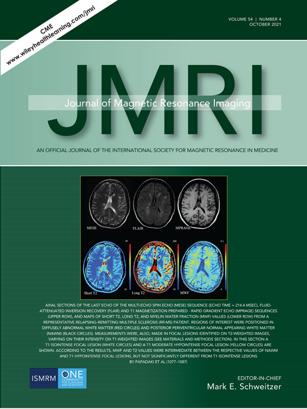 T2 Relaxometry Evidence of Microstructural Changes in Diffusely Abnormal White Matter in Relapsing–Remitting Multiple Sclerosis and Clinically Isolated Syndrome: Impact on Visuomotor Performance