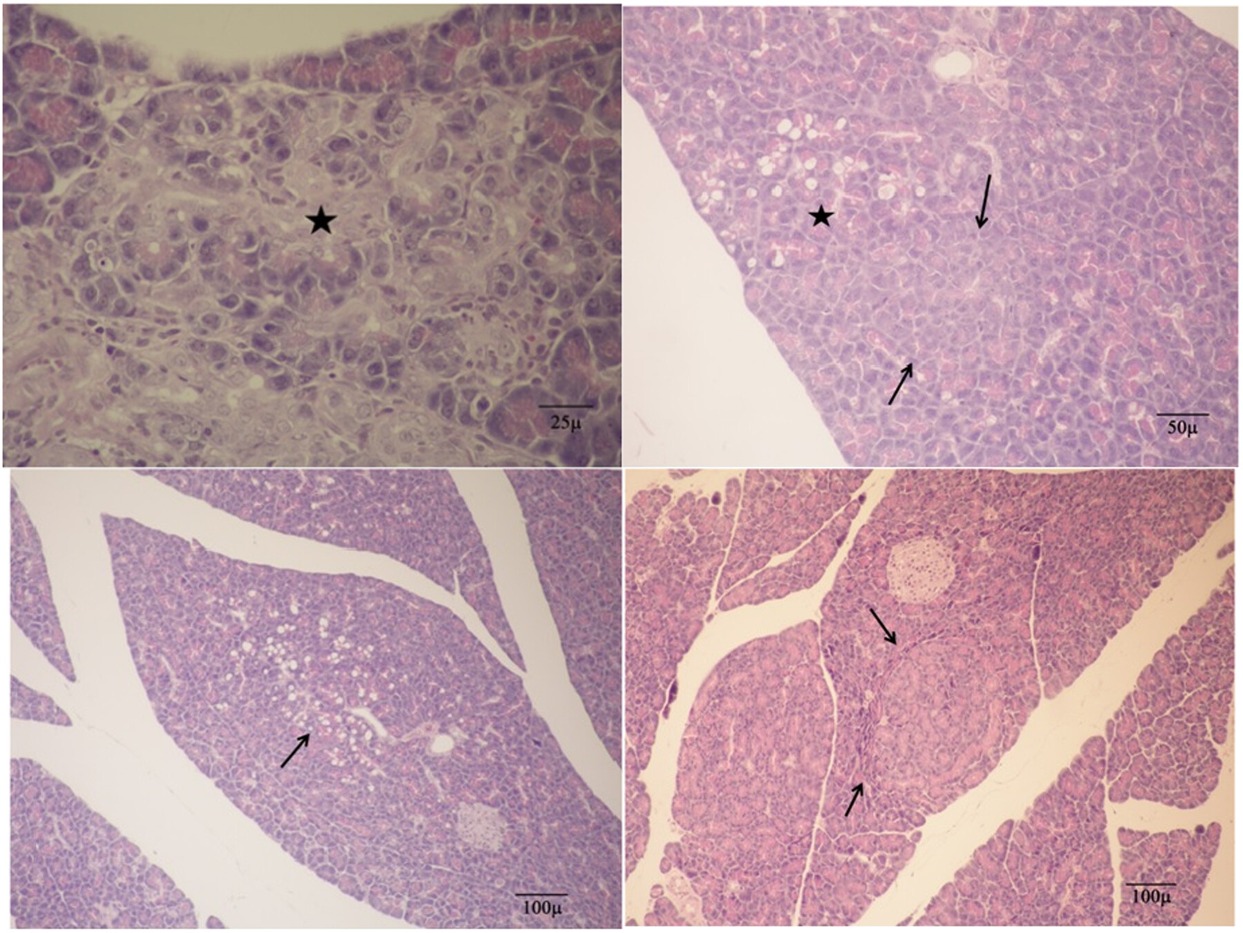 Antineoplastic Effects of Thymoquinone on Pancreatic Atypical Acinar Cell Foci Treated With Azaserine