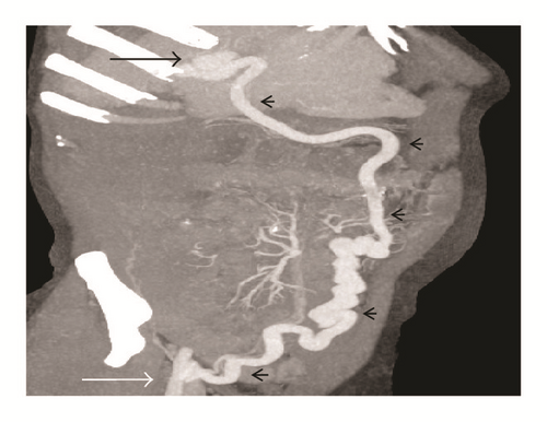 Details are in the caption following the image