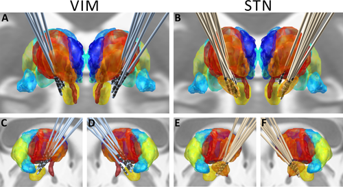 Details are in the caption following the image Details are in the caption following the image