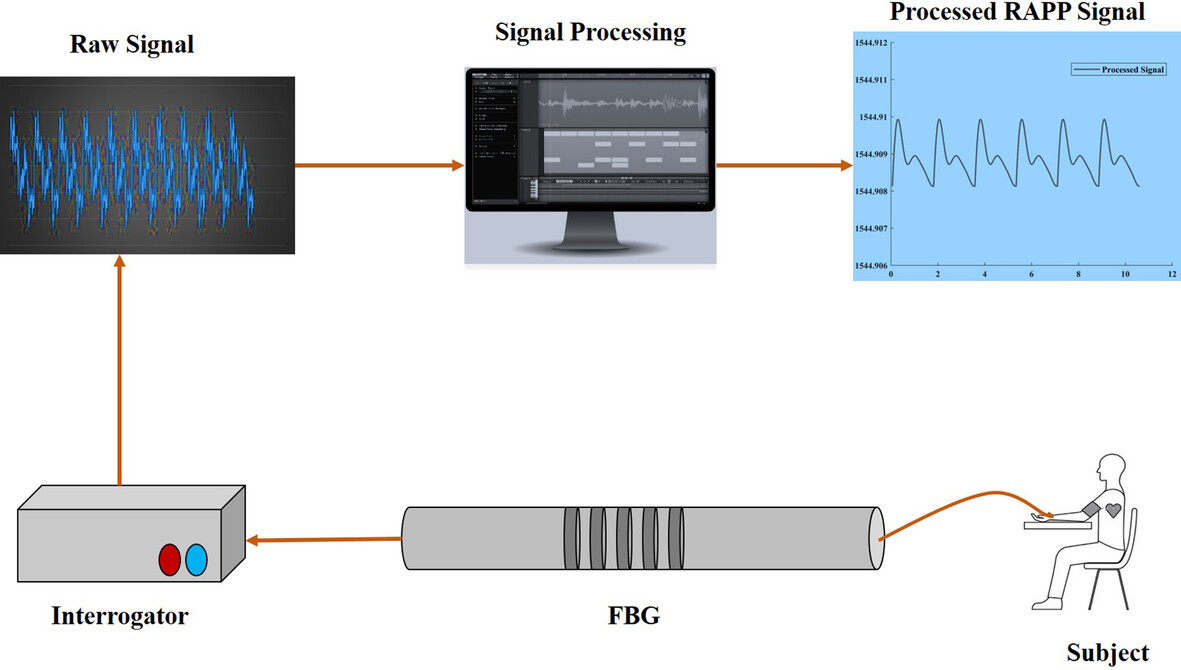An FBG-based optical pressure sensor for the measurement of radial artery pulse pressure