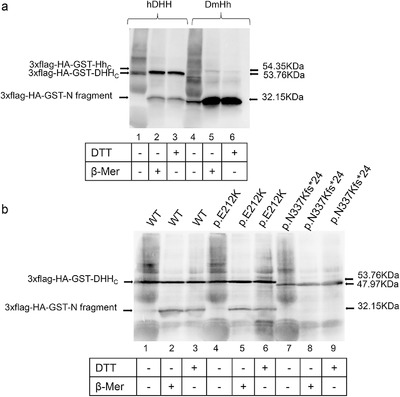 In vitro functional characterization of the novel DHH mutations p.(Asn337Lysfs*24) and p.(Glu212Lys) associated with gonadal dysgenesis