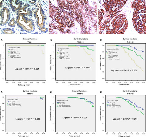 The role of tissue and serum carcinoembryonic antigen in stages I to III of colorectal cancer—A retrospective cohort study