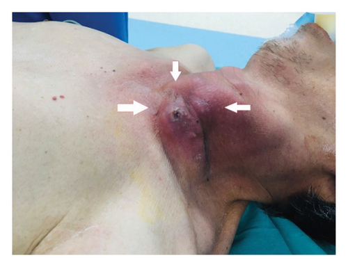 Details are in the caption following the image Details are in the caption following the image