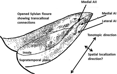 Medial–lateral organization of primary auditory cortex and the question of sound localization