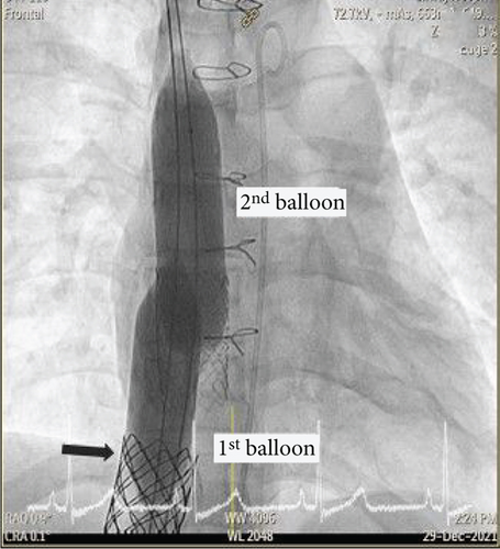 Details are in the caption following the image Details are in the caption following the image
