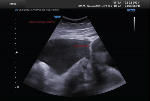 Details are in the caption following the image Details are in the caption following the image