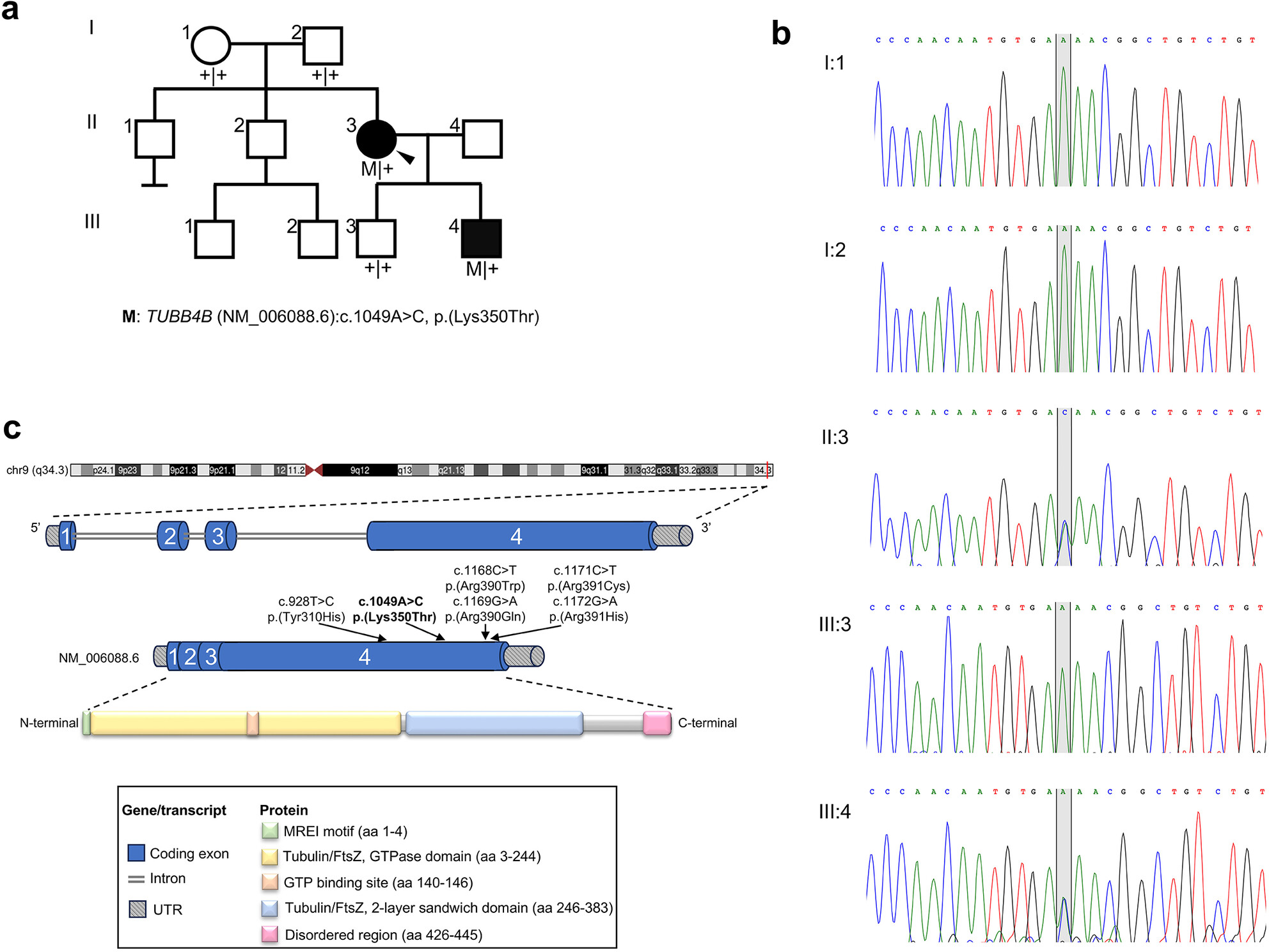 A Novel Variant in TUBB4B Causes Progressive Cone-Rod Dystrophy and Early Onset Sensorineural Hearing Loss