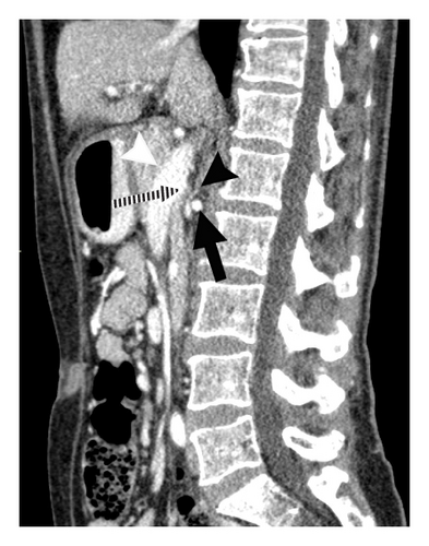 Details are in the caption following the image Details are in the caption following the image