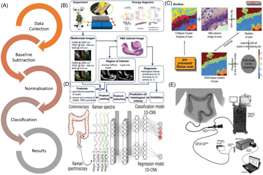 Review–Vibrational spectroscopy-aided diagnosis, prognosis and treatment of inflammatory bowel disease