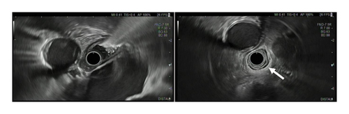 Details are in the caption following the image Details are in the caption following the image
