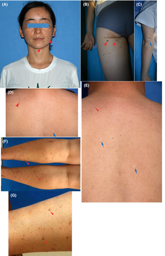 Details are in the caption following the image Details are in the caption following the image