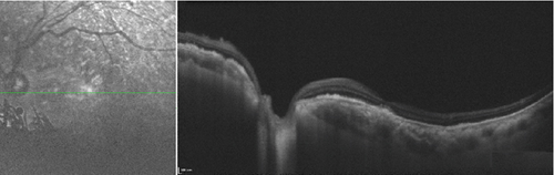 Details are in the caption following the image