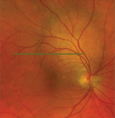 Details are in the caption following the image Details are in the caption following the image