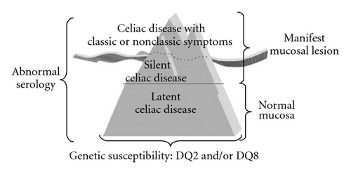 Details are in the caption following the image