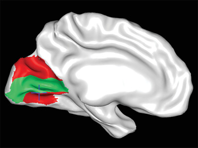 Analyzing the cortical fine structure as revealed by ex-vivo anatomical MRI