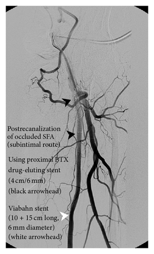 Details are in the caption following the image