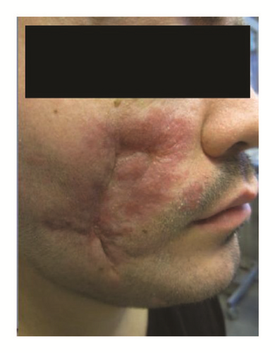 Details are in the caption following the image