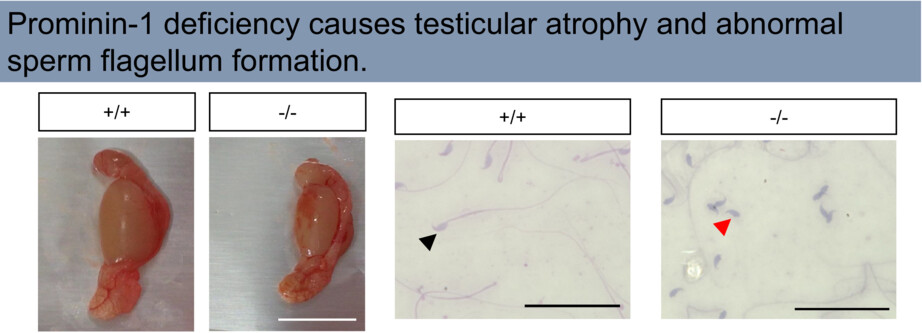 Prominin-1 deletion results in spermatogenic impairment, sperm morphological defects, and infertility in mice