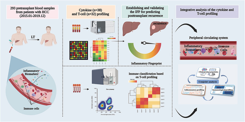 An inflammatory liquid fingerprint predicting tumor recurrence after liver transplantation for hepatocellular carcinoma